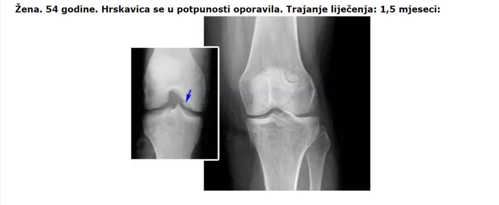 Herbolo kako se koristi