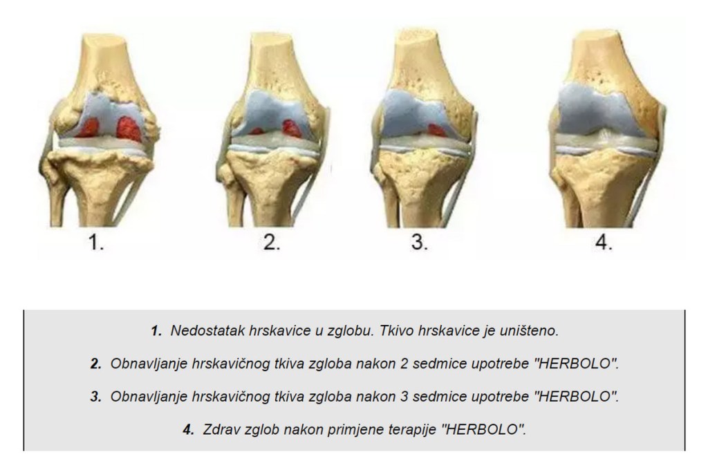 kako djeluje Herbolo gel